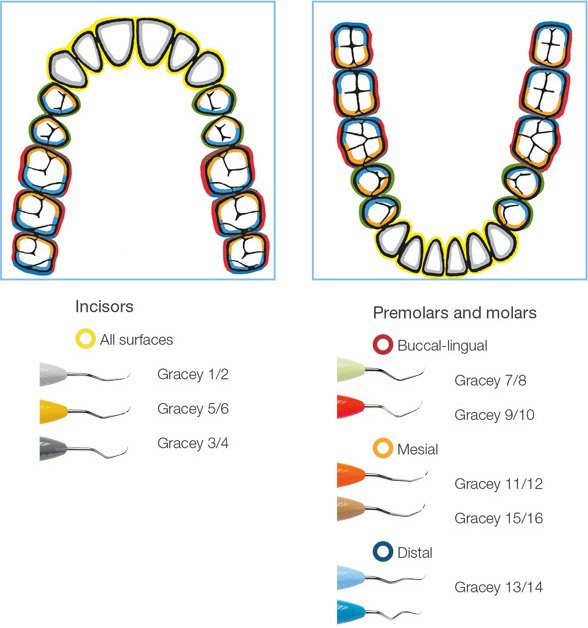 LM Ergomax Macro Mesial Distal Gracey 41609 - DMI Ireland's Leading Dental Supplier - Next Day Delivery
